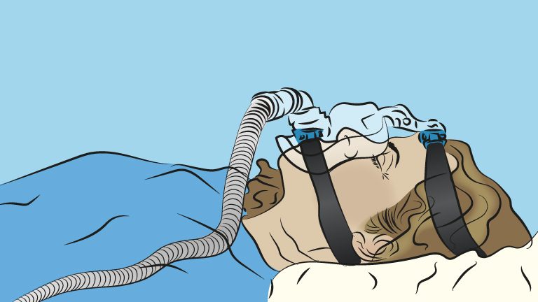 En pasient som får hjelp ved å bruke en CPAP ventil
